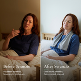 Seranzio Brume — before and after